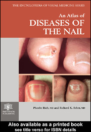 An Atlas of Diseases of the Nail